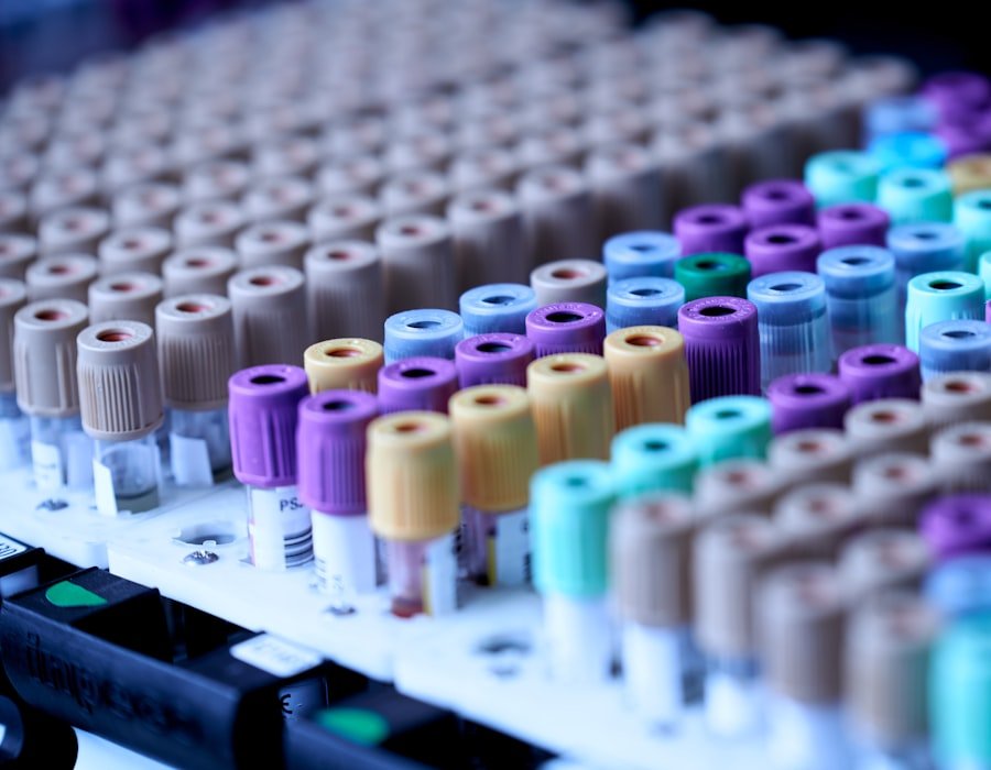 Racks of laboratory sample tubes ready for testing